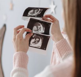 How to Become a Sonographer