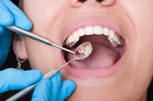 How to Become a Dental Hygienist 3 Average Salary Range of a Dental Hygienist