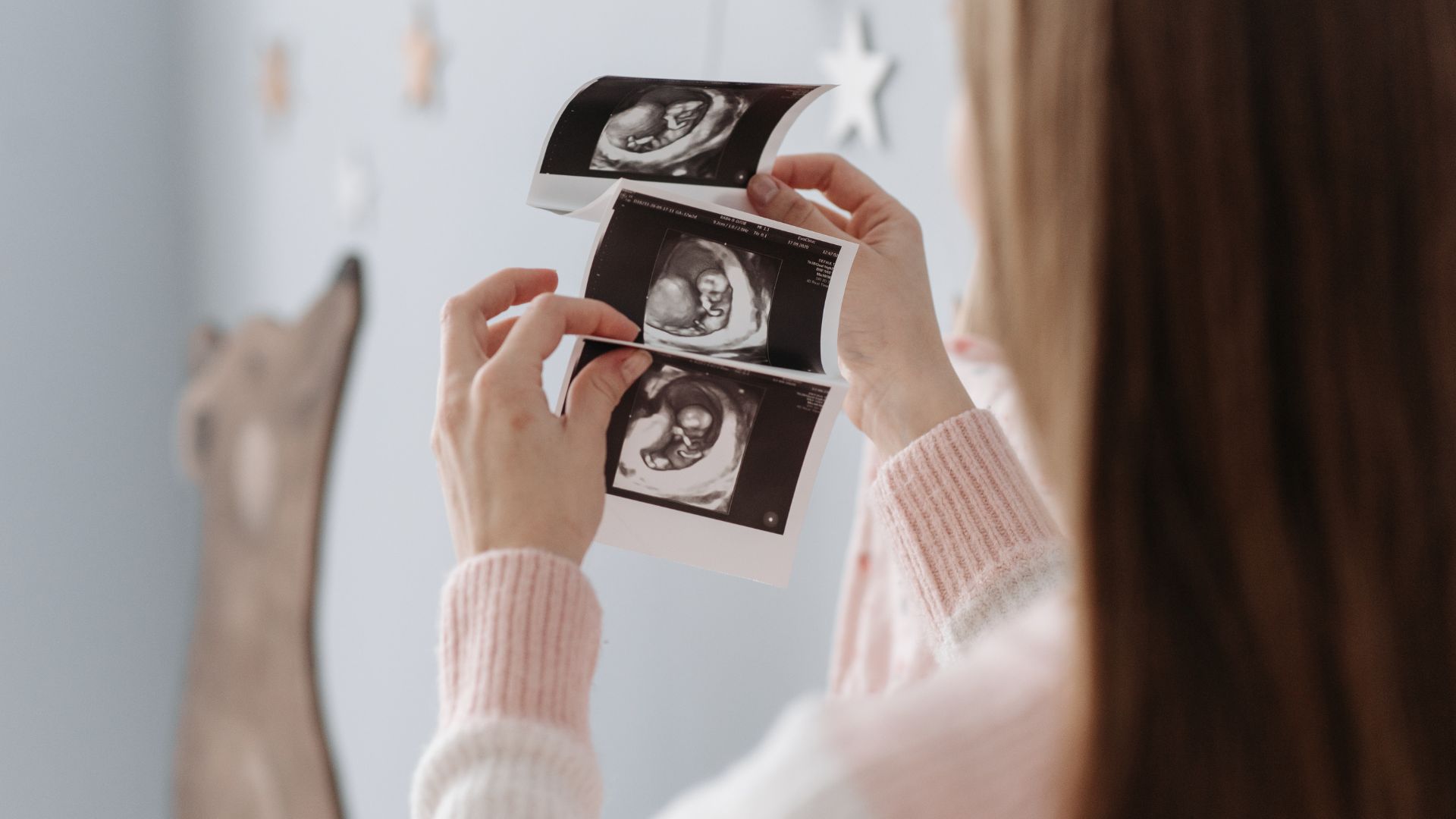 How to Become a Sonographer